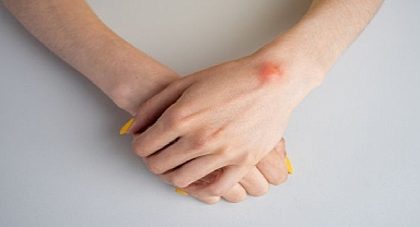 Yağ Bezesi Hakkında Doğru Bilinen 5 Yanlış!