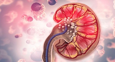 Böbrek Taşına Yol Açan 8 Önemli Hata!